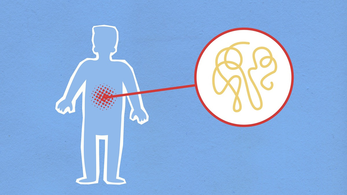 Ayurveda: Improving digestion for health - AMA
